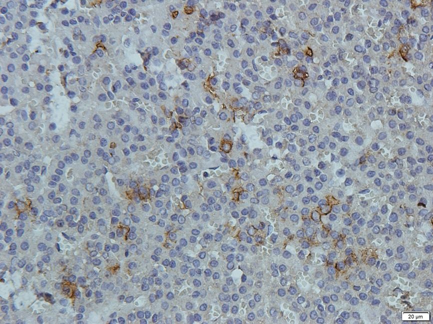 RANK Rabbit Polyclonal Antibody