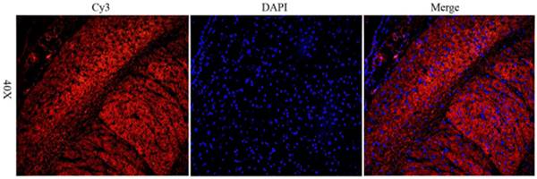 CD206 Rabbit Polyclonal Antibody