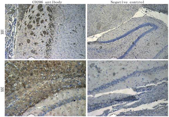 CD206 Rabbit Polyclonal Antibody