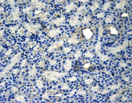 CD206 Rabbit Polyclonal Antibody