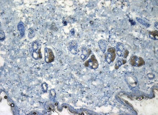 CD206 Rabbit Polyclonal Antibody