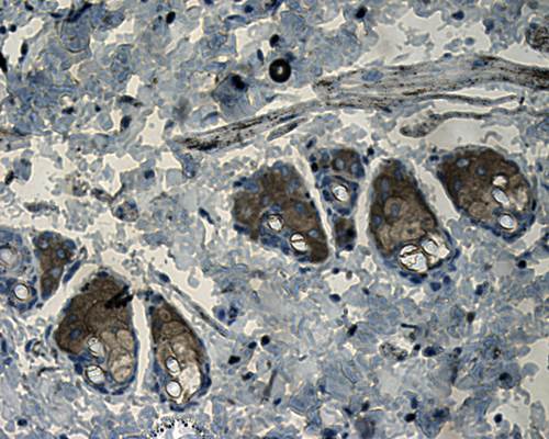 CD206 Rabbit Polyclonal Antibody