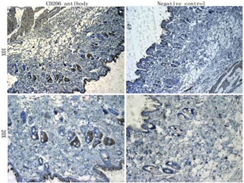 CD206 Rabbit Polyclonal Antibody