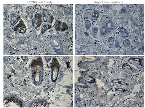 CD206 Rabbit Polyclonal Antibody