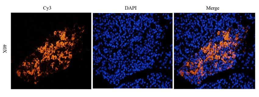Syndecan 2 Rabbit Polyclonal Antibody