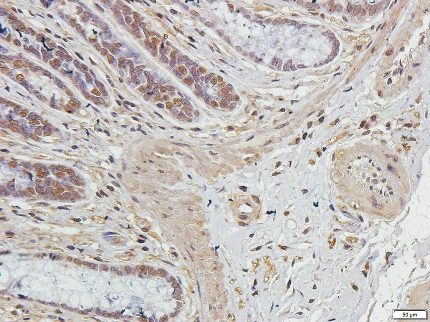 Syndecan 2 Rabbit Polyclonal Antibody