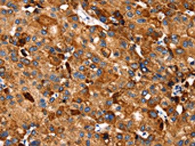 SLC27A5 Antibody