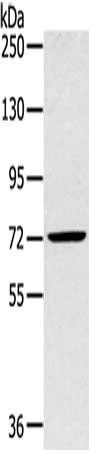 SLC27A5 Antibody