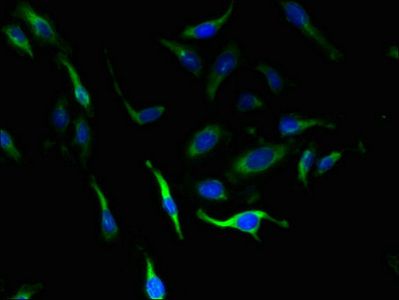 SLC4A8 Antibody