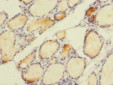 SLC4A8 Antibody