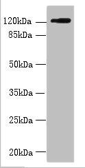 SLC4A8 Antibody