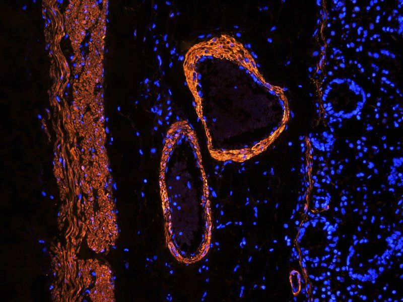 ACTA2 Rabbit Polyclonal Antibody