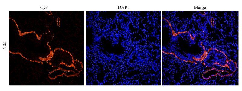 ACTA2 Rabbit Polyclonal Antibody