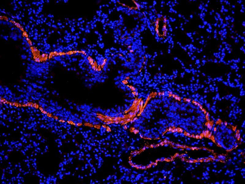 ACTA2 Rabbit Polyclonal Antibody