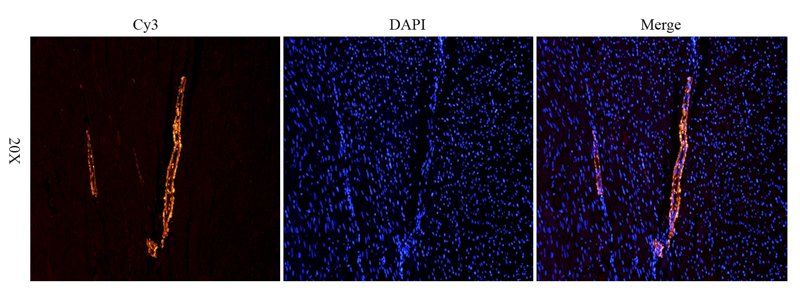 ACTA2 Rabbit Polyclonal Antibody