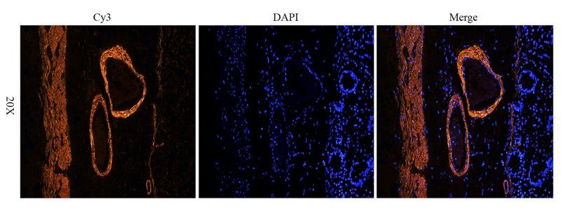ACTA2 Rabbit Polyclonal Antibody