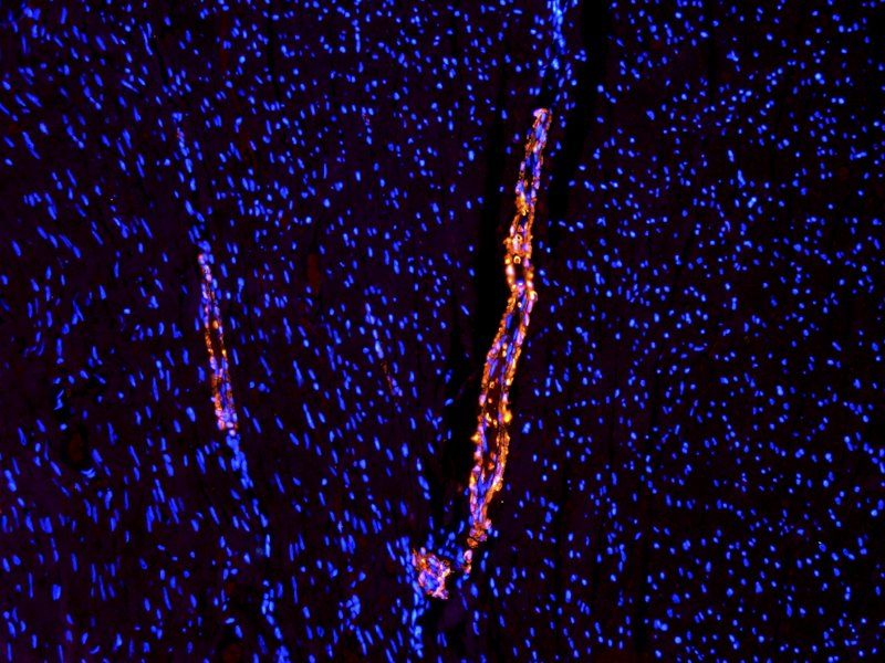 ACTA2 Rabbit Polyclonal Antibody