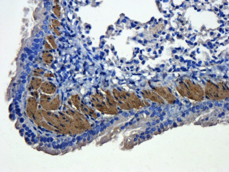 ACTA2 Rabbit Polyclonal Antibody