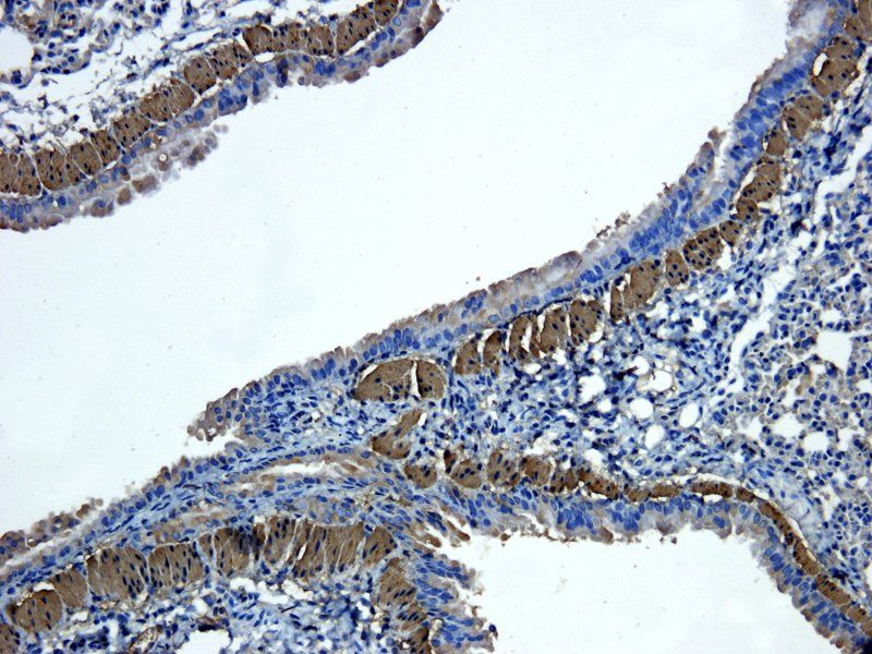 ACTA2 Rabbit Polyclonal Antibody