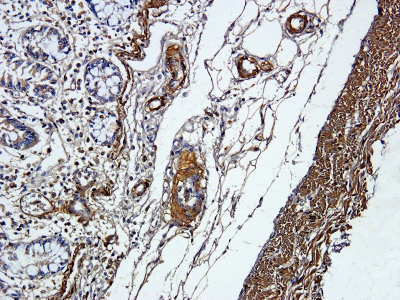 ACTA2 Rabbit Polyclonal Antibody