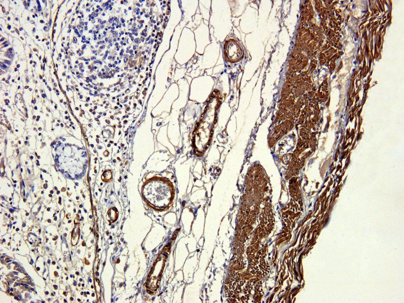 ACTA2 Rabbit Polyclonal Antibody