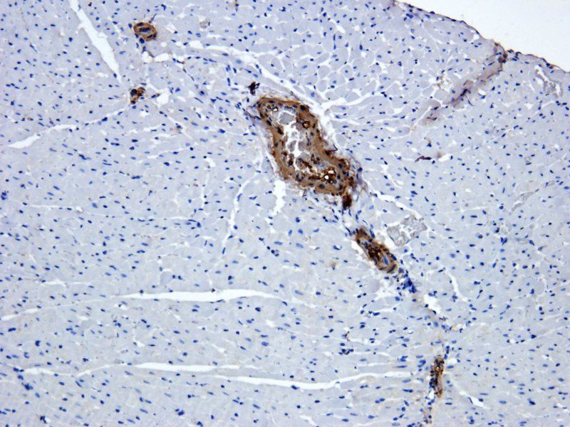 ACTA2 Rabbit Polyclonal Antibody