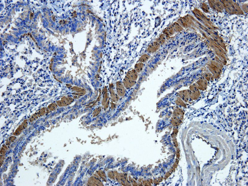 ACTA2 Rabbit Polyclonal Antibody