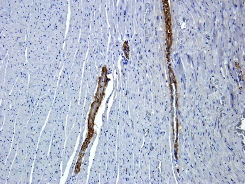ACTA2 Rabbit Polyclonal Antibody