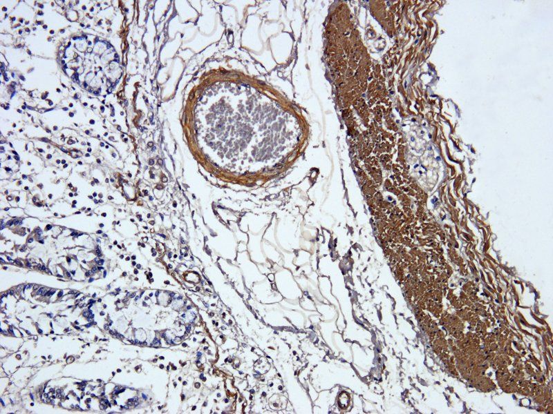 ACTA2 Rabbit Polyclonal Antibody