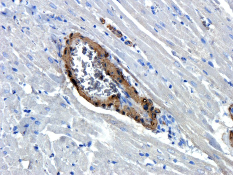 ACTA2 Rabbit Polyclonal Antibody