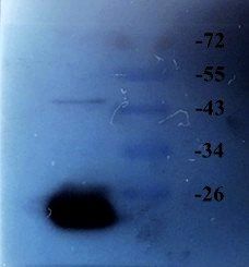 ACTA2 Rabbit Polyclonal Antibody