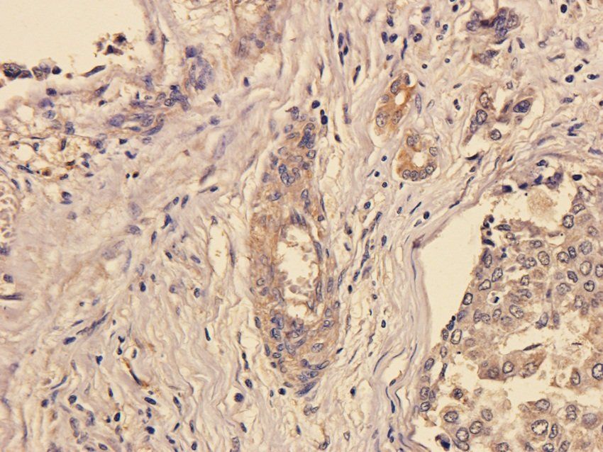 SOX2 Rabbit Polyclonal Antibody