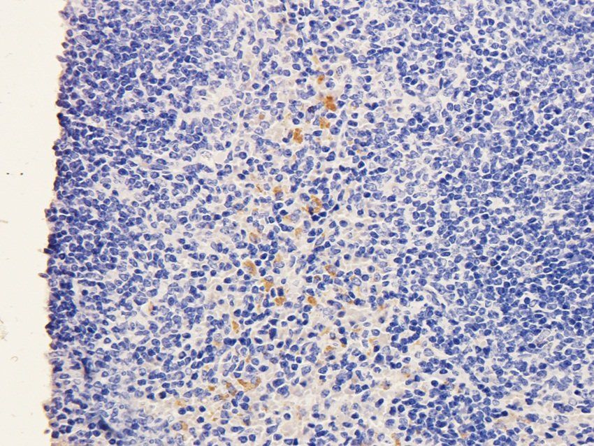 SOX2 Rabbit Polyclonal Antibody