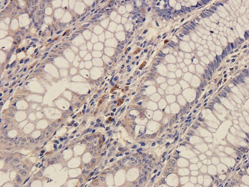 SOX2 Rabbit Polyclonal Antibody