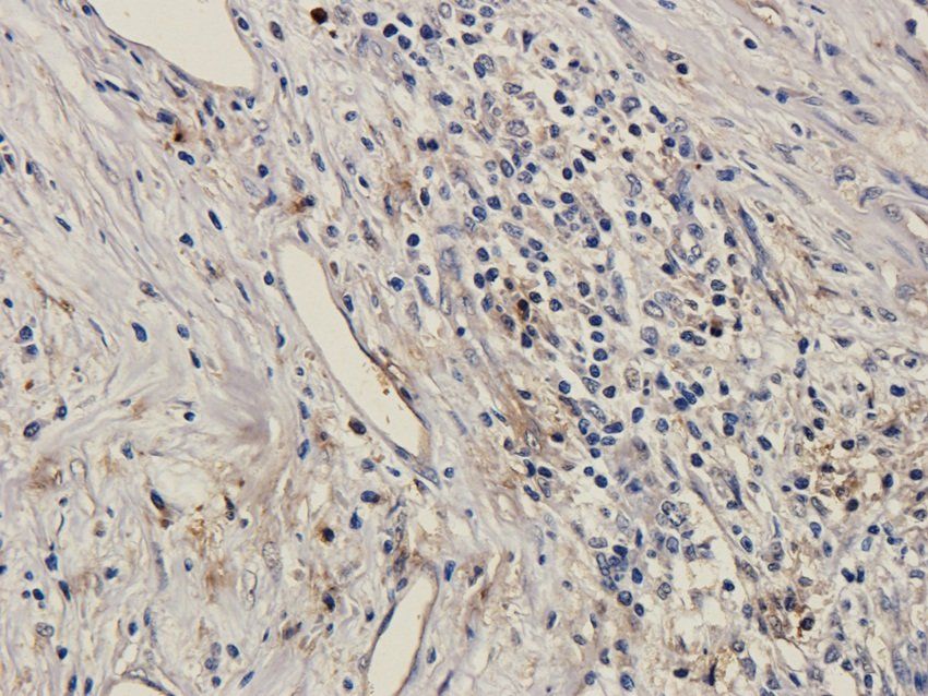 SOX2 Rabbit Polyclonal Antibody