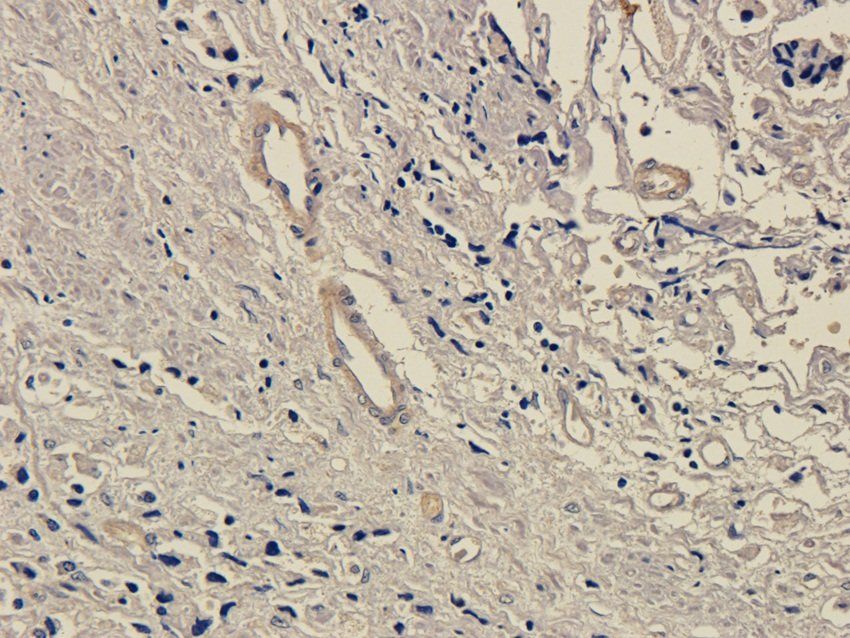 SOX2 Rabbit Polyclonal Antibody