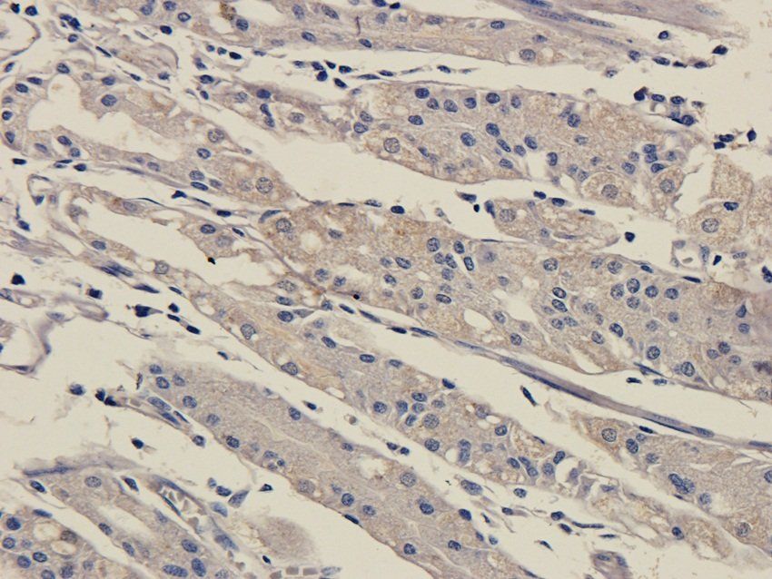 SOX2 Rabbit Polyclonal Antibody