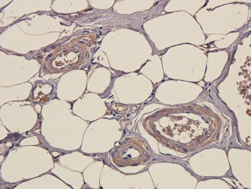 SOX2 Rabbit Polyclonal Antibody