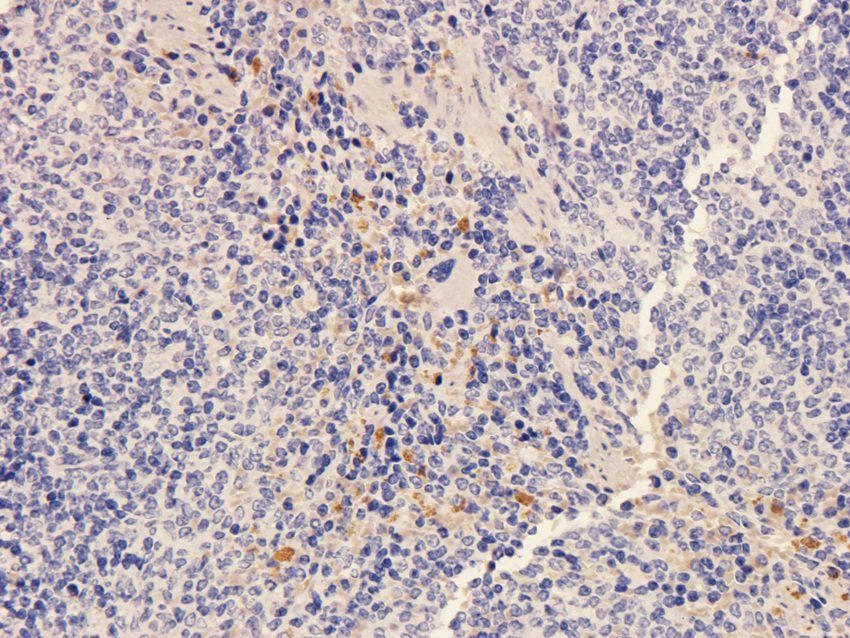 SOX2 Rabbit Polyclonal Antibody
