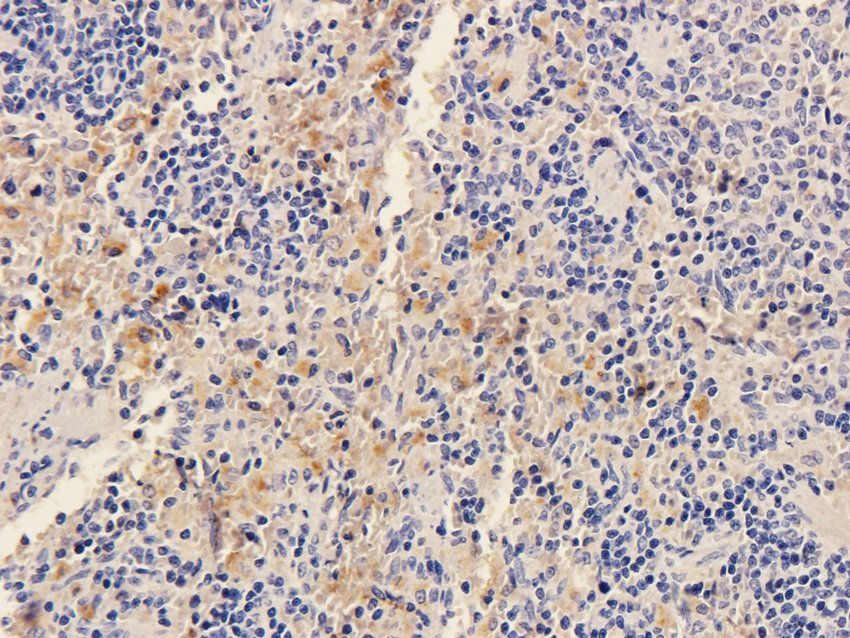 SOX2 Rabbit Polyclonal Antibody