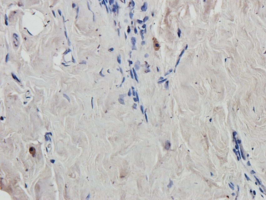 SOX9 Rabbit Polyclonal Antibody
