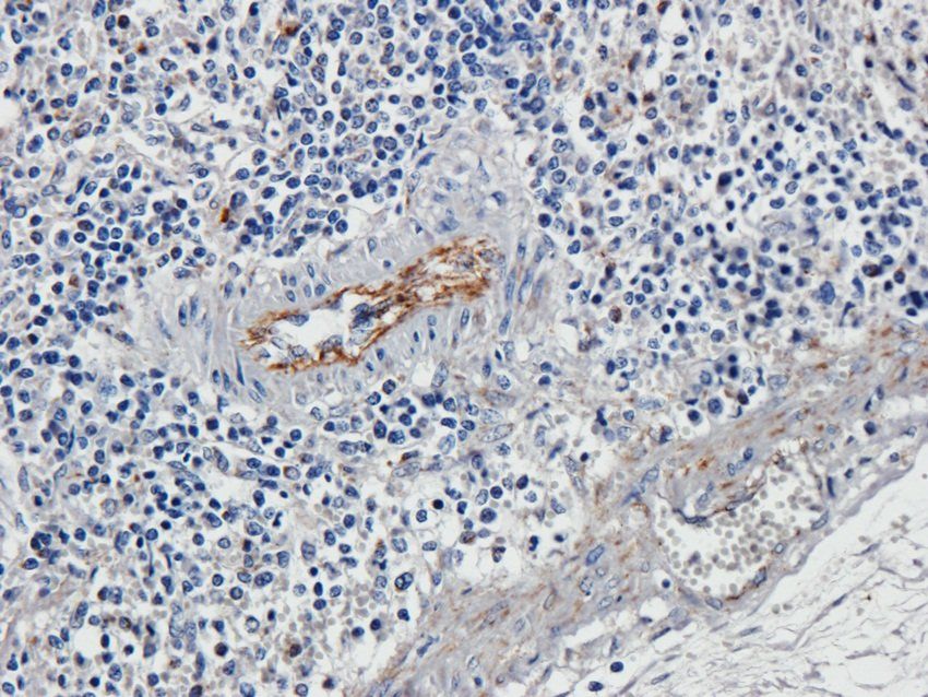 SOX9 Rabbit Polyclonal Antibody
