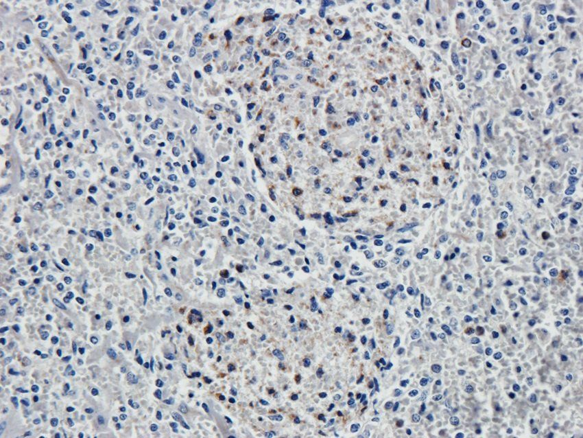 SOX9 Rabbit Polyclonal Antibody