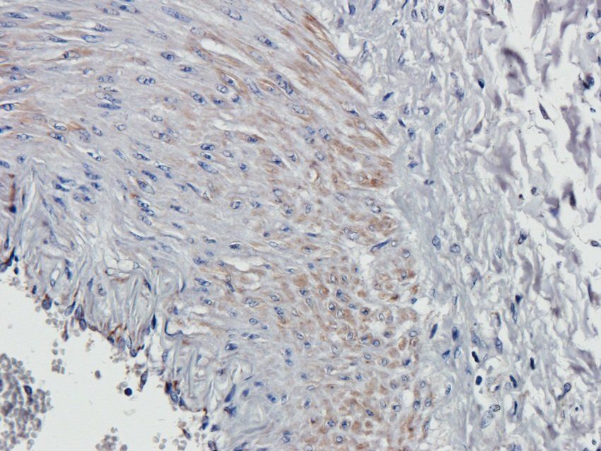 SOX9 Rabbit Polyclonal Antibody
