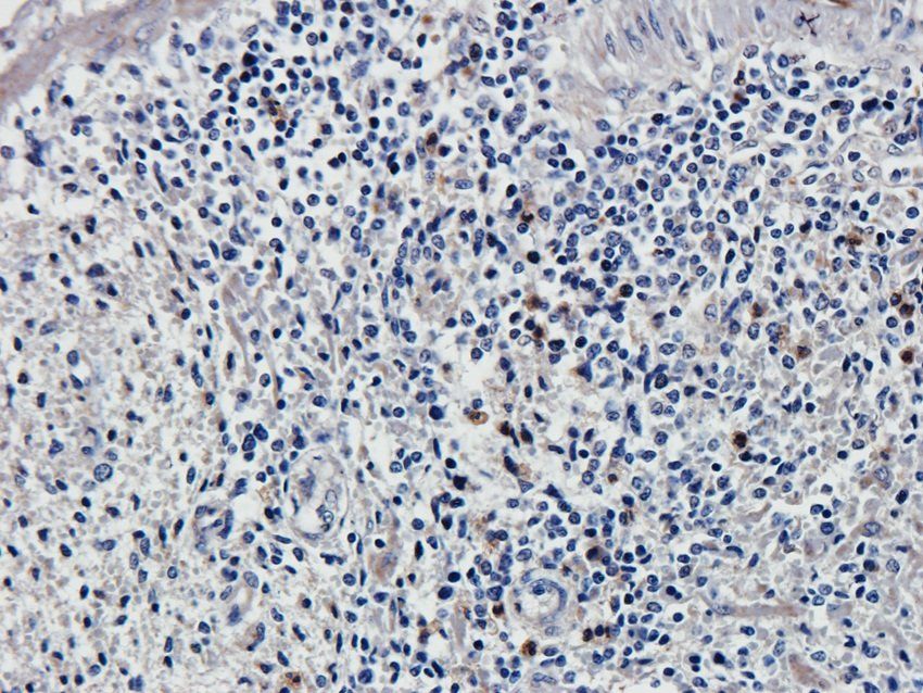 SOX9 Rabbit Polyclonal Antibody