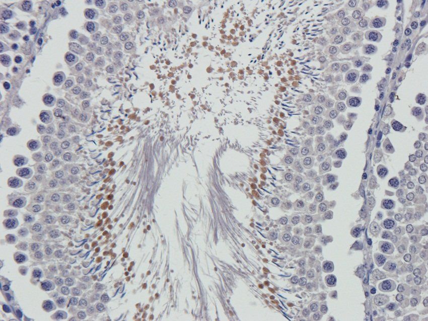 SOX9 Rabbit Polyclonal Antibody
