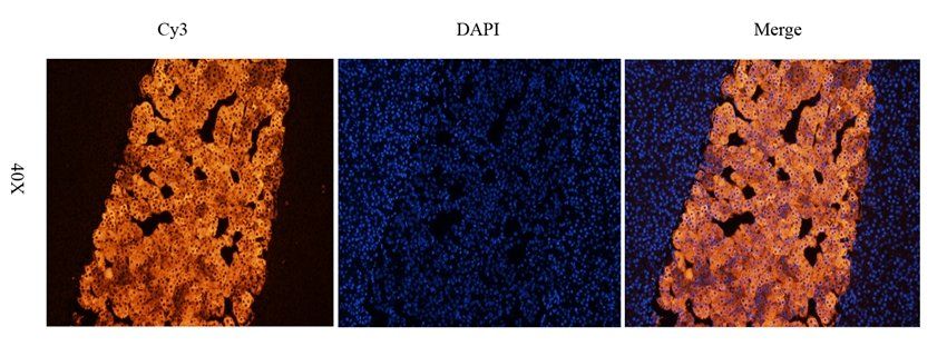 Tyrosine Hydroxylase Rabbit Polyclonal Antibody