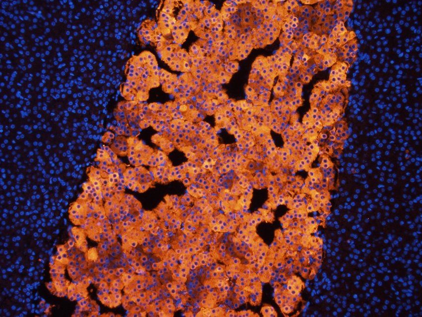 Tyrosine Hydroxylase Rabbit Polyclonal Antibody