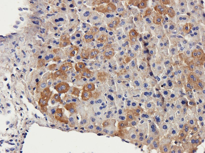 Tyrosine Hydroxylase Rabbit Polyclonal Antibody