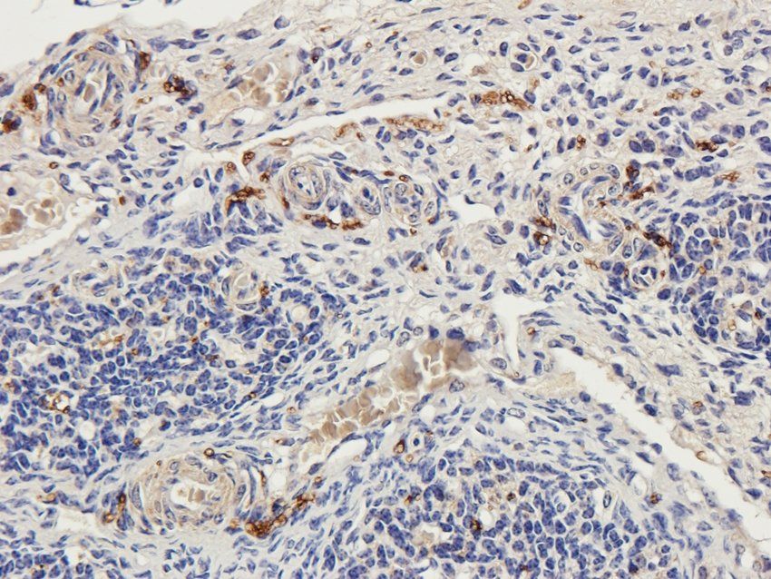Tyrosine Hydroxylase Rabbit Polyclonal Antibody